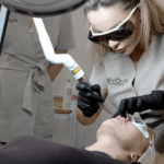 Lifting twarzy laserem Fotona Inowrocław