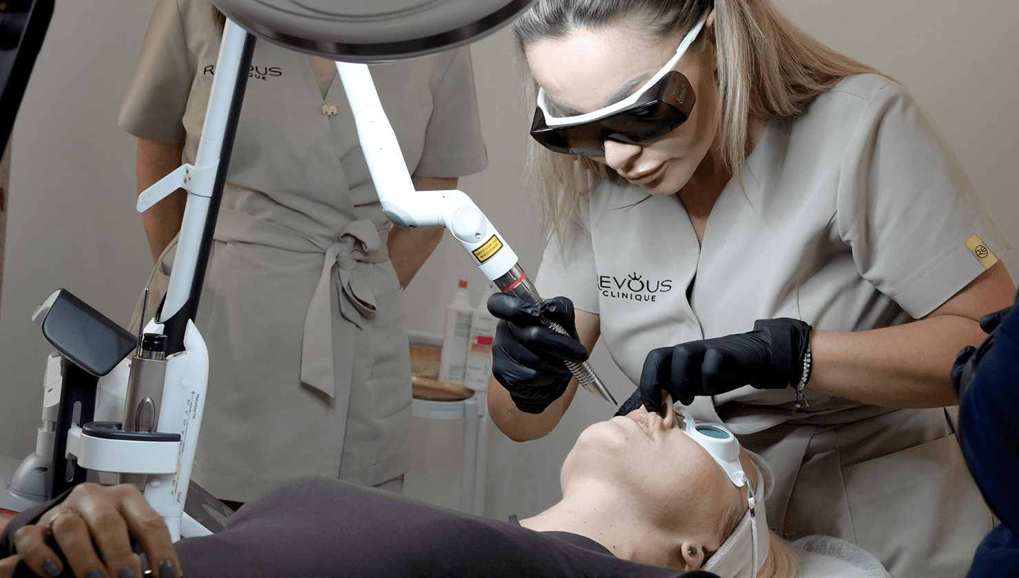 Lifting twarzy laserem Fotona Inowrocław