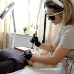 Laserowy lifting twarzy