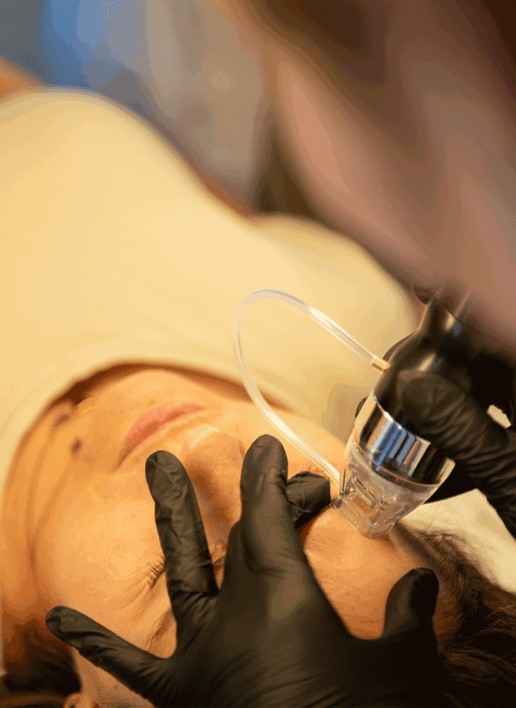 Zabieg na twarz inowrocław